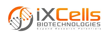 iXCells Biotechnologies Appoints Steve Smith as Chief Executive Officer
