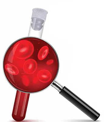 Blood to Plasma Ratio