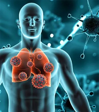 Tuberculosis Diagnosis