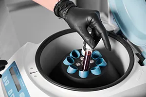 Integrated multi-omics profiling from a single biological sample