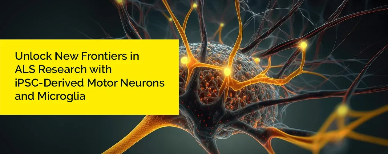 artorius-ipsc-motor-neurons-microglia-in-als-white-paper-en-banner